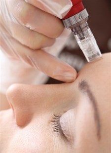 Microneedling (Collagen Induction Therapy) Photo